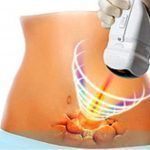 HIFU ABDOMEN