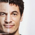 REJUVENECIMIENTO FACIAL
