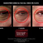 BORNE 15 ONIX OJOS